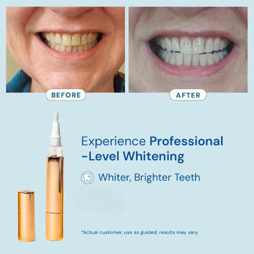 Plesyy - Whitening Pen